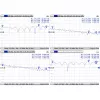 Kaapeli Mmcx to RPSMA/ACMMCXRPSMA Mikrotik