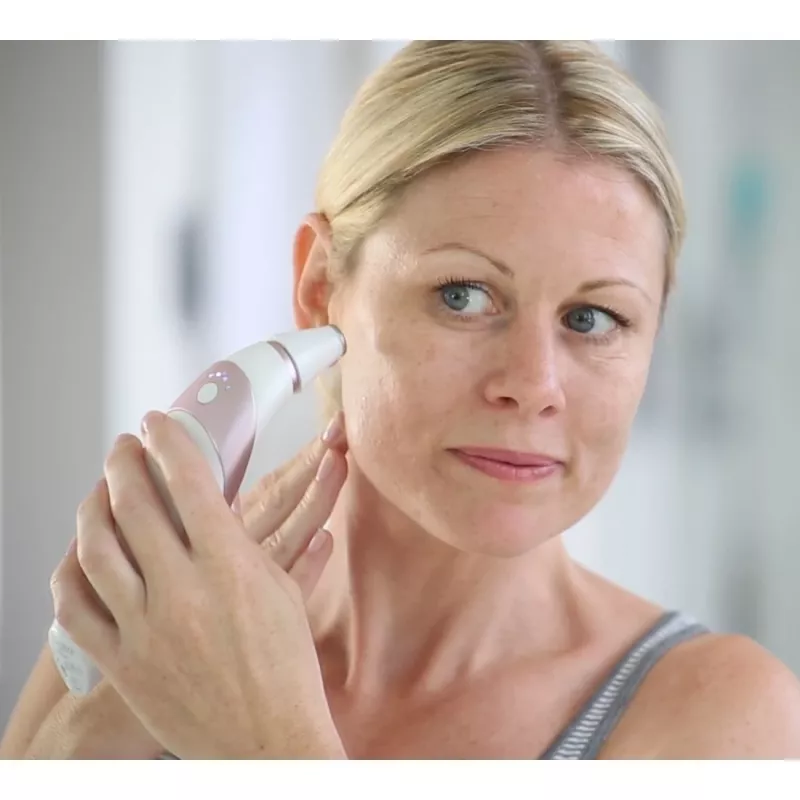 HoMedics Radiance ihonhoitolaite ihon vakuumi-mikrodermabraasio ruusukulta, valkoinen