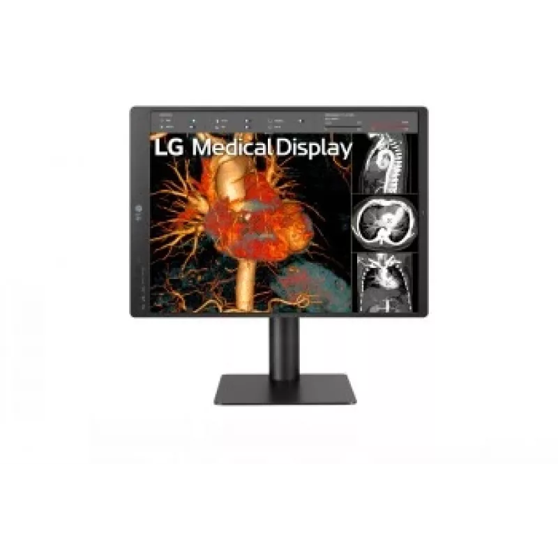 LG 21,3